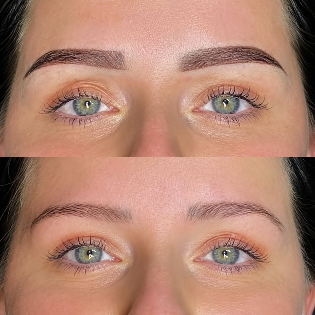Treatment result