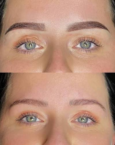 Treatment result